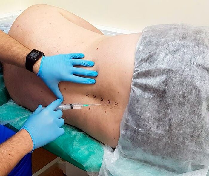 Blocages médicaux pour le dos