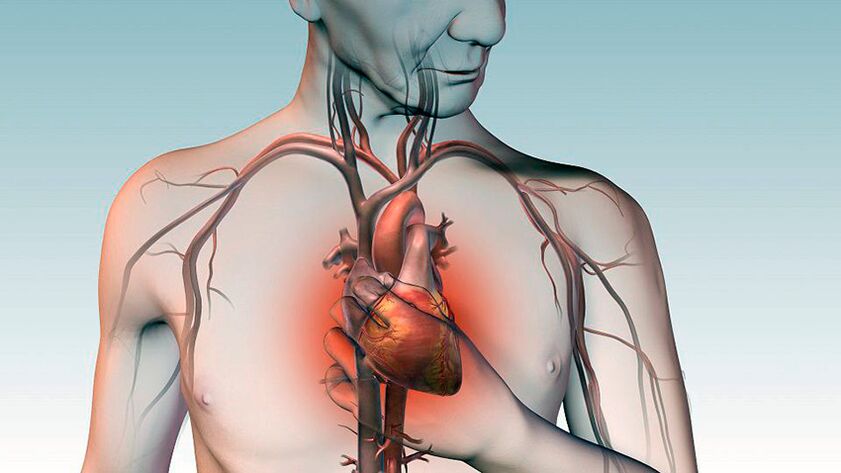 Douleur sous l'omoplate et douleurs douloureuses derrière le sternum dans les maladies cardiaques